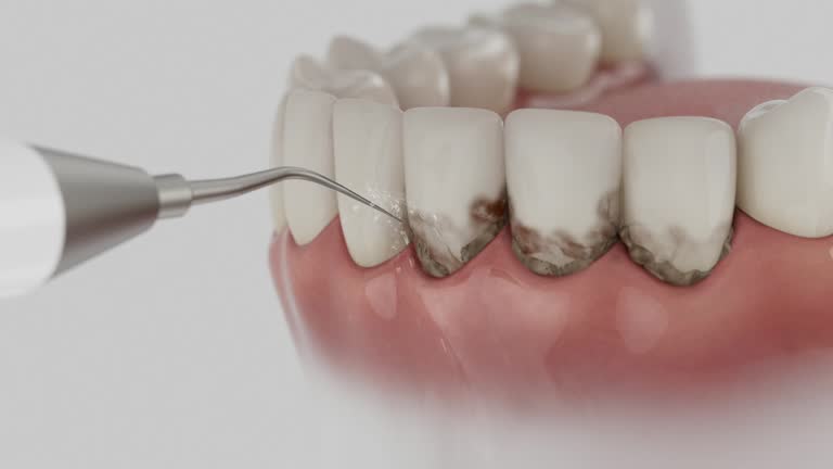 Reliable Emergency Dentist contractor in Gladewater, TX by Smile Center Dentistry